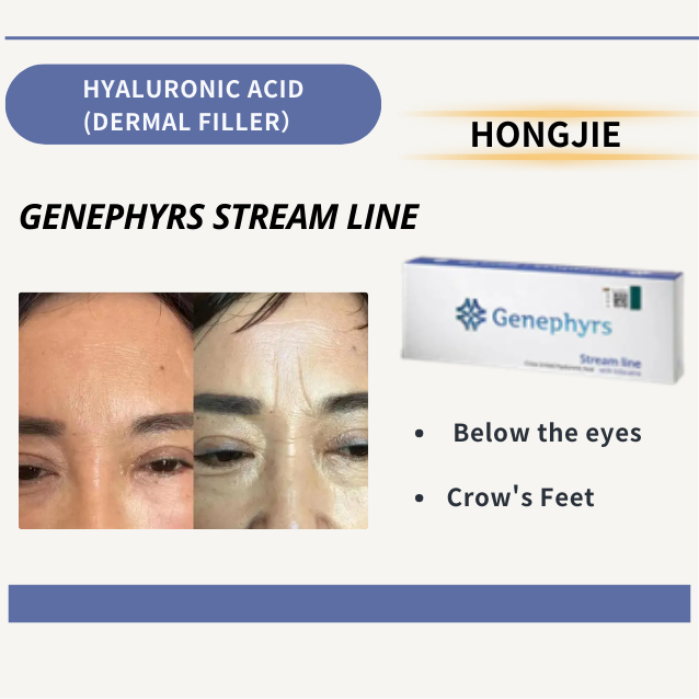 genephyrs stream line