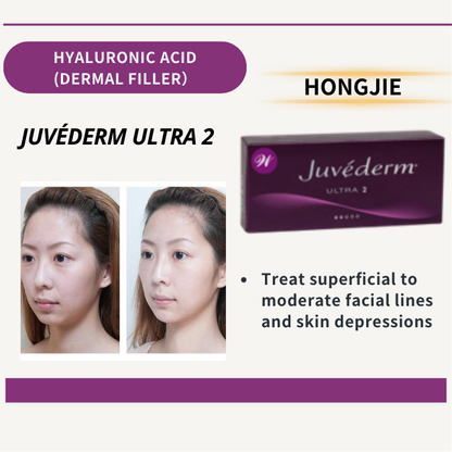 JUVÉDERM ULTRA 2