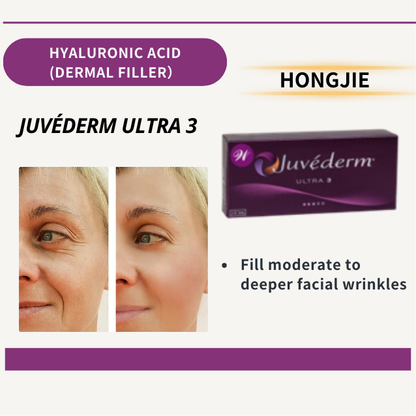 JUVÉDERM ULTRA 3