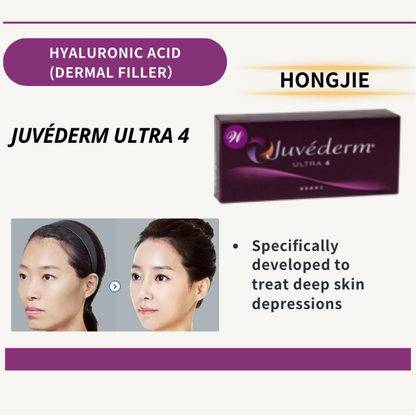 JUVÉDERM ULTRA 4